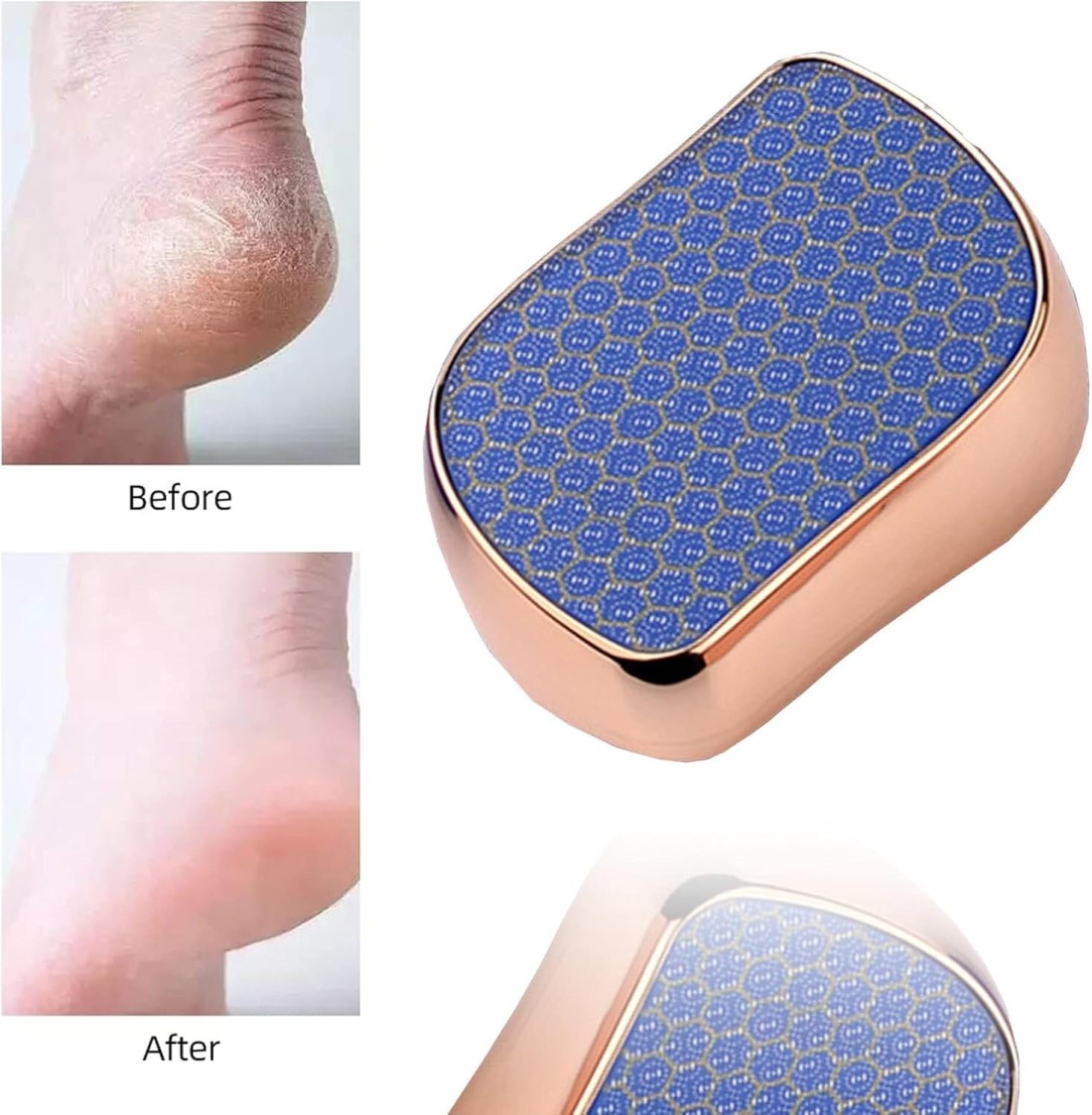 Nano Glass Callus Remover Foot File &ndash; High-Density Pedicure Tool for Hard Skin, Dead Skin, Corn Removal, and Cracked Heels