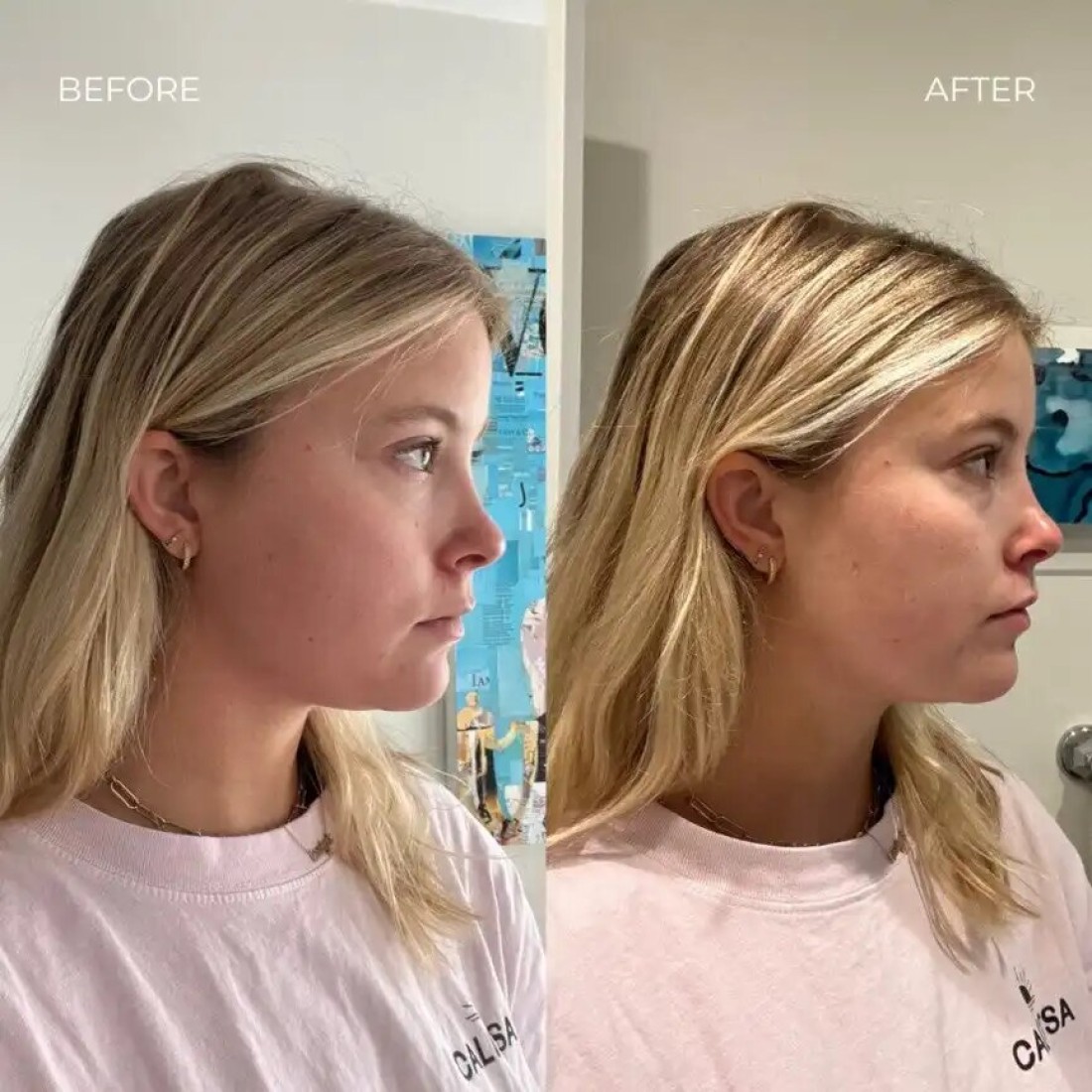 Slimming Face and Neck V-Line Lifting Mask – Firming Double Chin Up Lift Mask for Neck & Jawline – Tightening and Sculpting Treatment for a Slimmer Face (1pcs)
