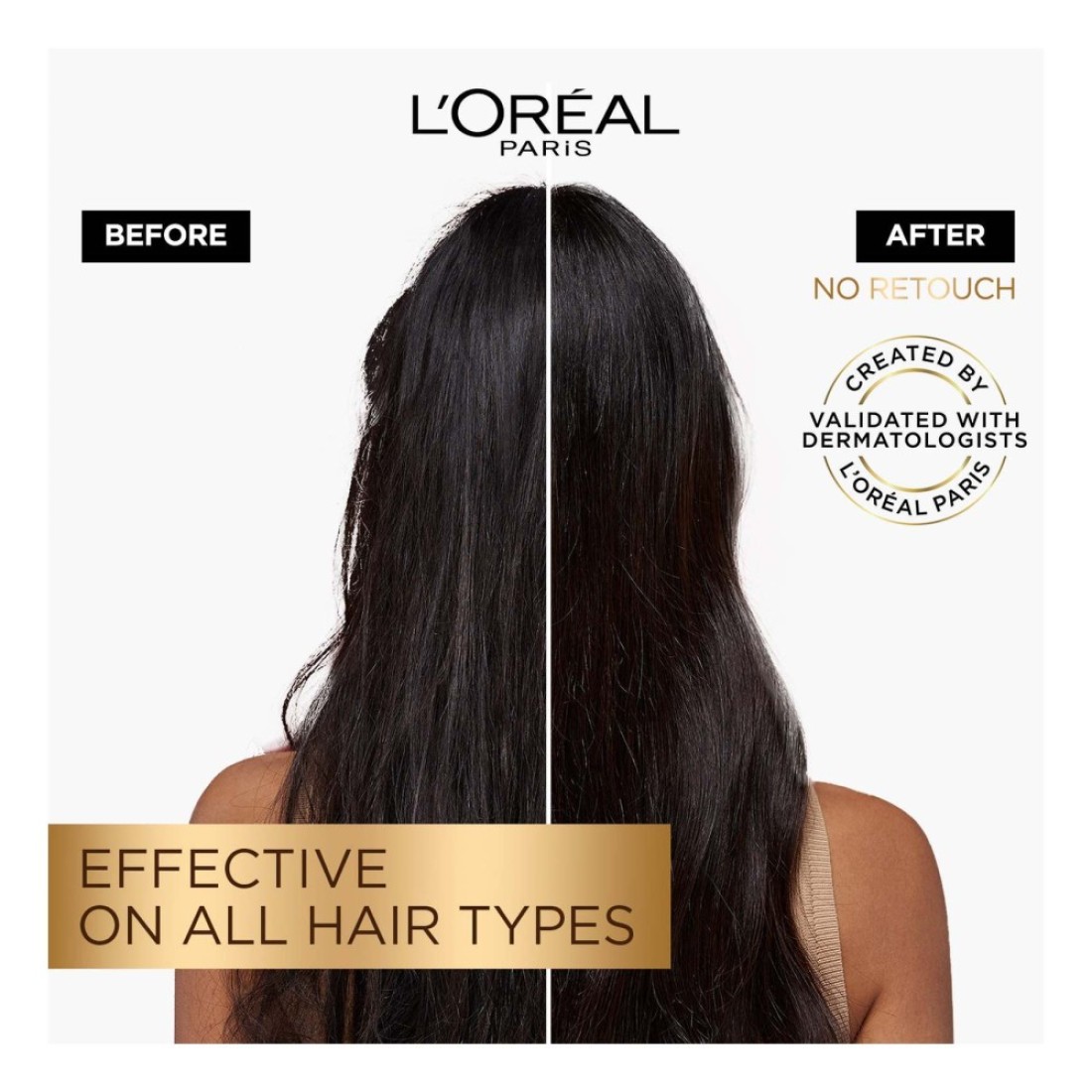 L&#39;Oreal Paris Elvive Full Resist Anti Hair-Fall Serum With Aminexil 102ml