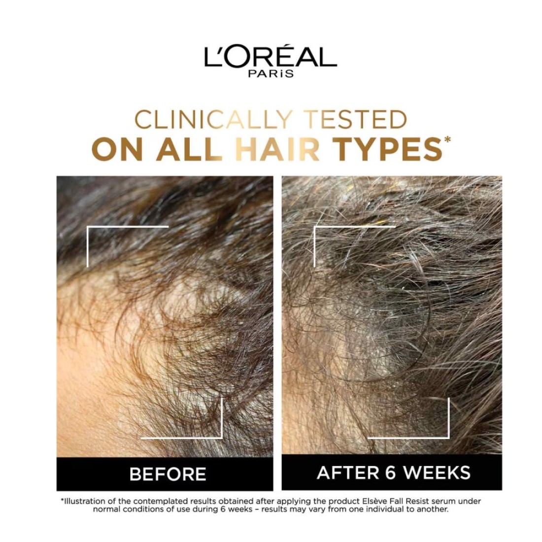 L&#39;Oreal Paris Elvive Full Resist Anti Hair-Fall Serum With Aminexil 102ml