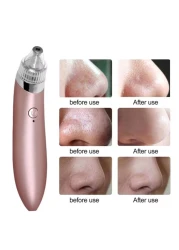 Generic Vacuum Facial Pore Cleanser Electric Blackhead Remover 180X42X39Millimeter