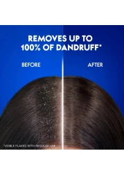 هيد اند شولدرز شامبو كلاسيك كلين ضد القشرة 1000 ملل حزمة من 2