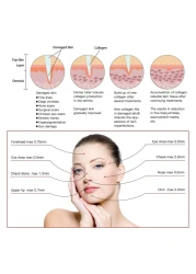 Dr Pen M5 Ultima Derma Pen Professional Electric Microneedle for Anti-aging Acne Scars Wrinkles with 2pcs 12PIN Cartridges