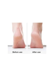 Remover Electric Foot Grinder for Hard Skin, Professional Velvet-Smooth Pedicure Tools, Dual Charging Methods, Callus Remover for Soft Feet, White + Red