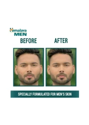 Himalaya Herbals Men Pimple Clear Neem Face Wash Green 100ml