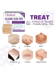 Silicone Scar Sheets16 x 60Roll15M Soft Silicone Gel Scar Tape Painless Silicone Tape Roll Reusable Medical Grade Silicone Scar Removal Strips for CSectio