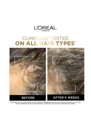 L&#39;Oreal Paris Elvive Full Resist Anti Hair-Fall Serum With Aminexil 102ml